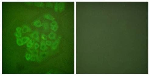 GR (Ab-211) Antibody