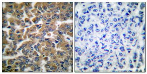 GR (Ab-211) Antibody
