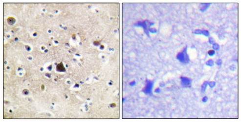GR (Ab-226) Antibody