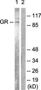 GR (Ab-226) Antibody