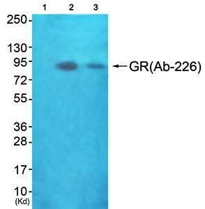 GR (Ab-226) Antibody