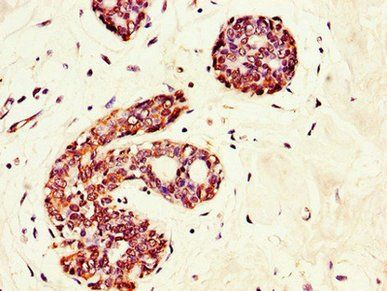 GRAMD4 Antibody