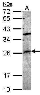GRAP Rabbit Polyclonal Antibody