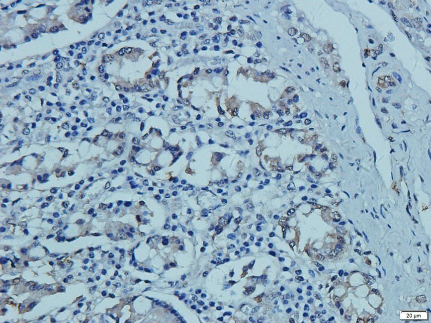 CD41 Antibody