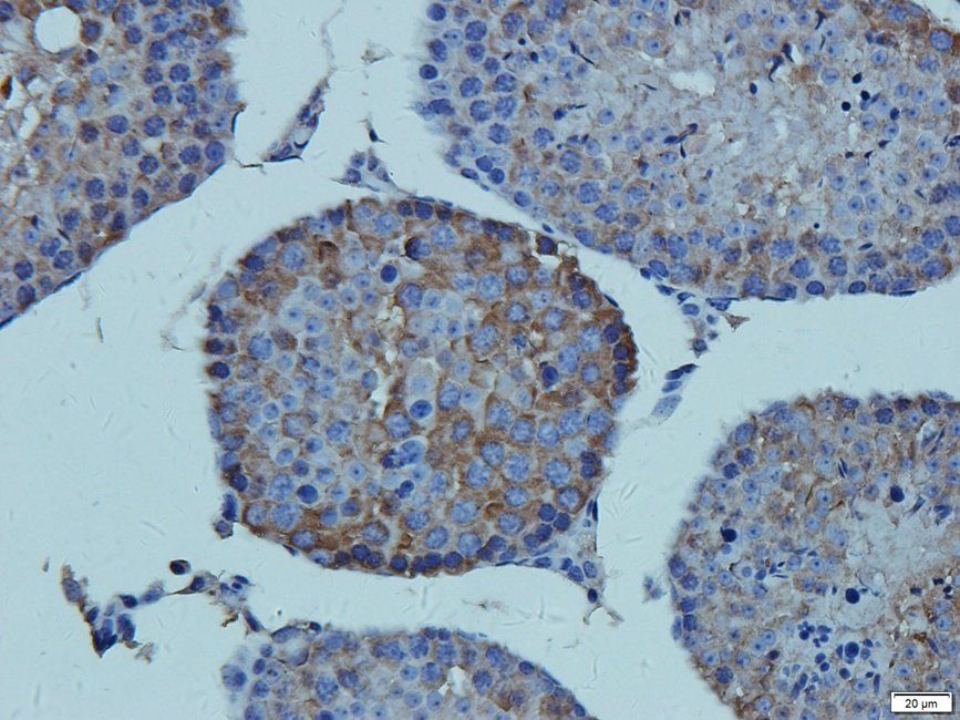 CD41 Antibody