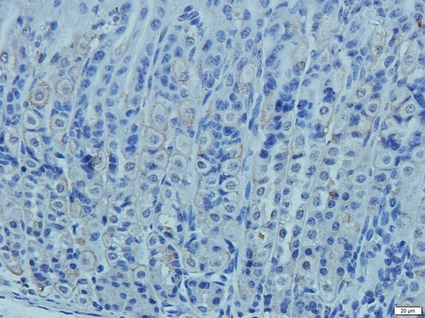 CD41 Antibody