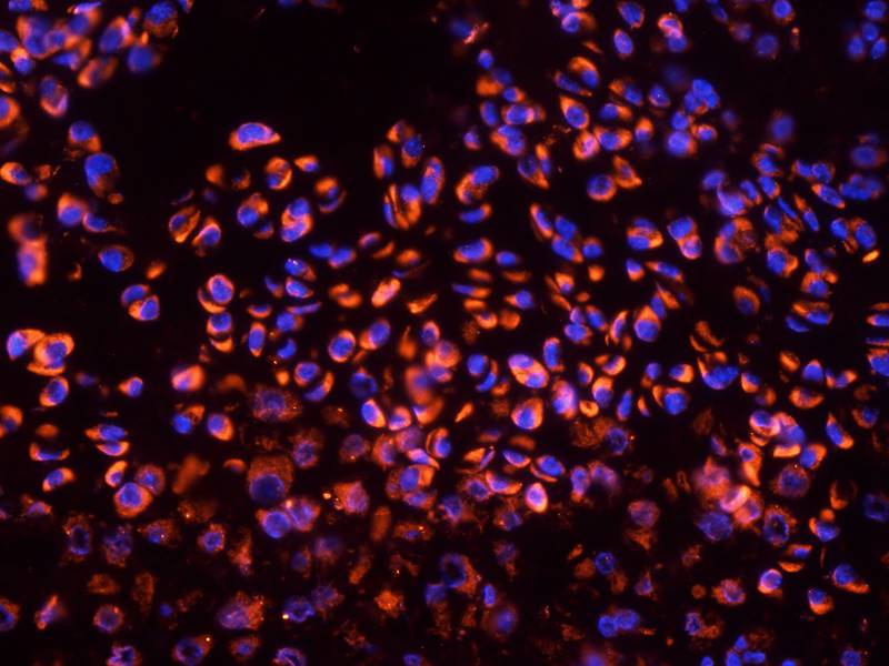 Gremlin 1 antibody