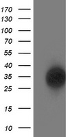 GRHPR Antibody