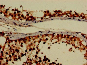 GRHPR Antibody