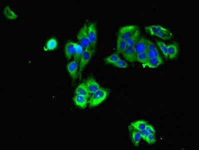 GRIA3 Antibody