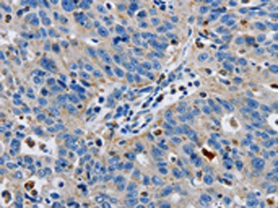 GRIA3 Antibody
