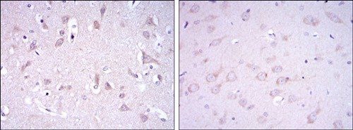 GRIA3 Antibody