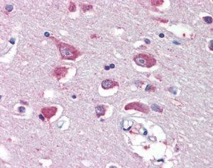 GRIA4 Antibody