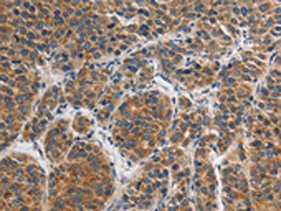 GRIN1 Antibody