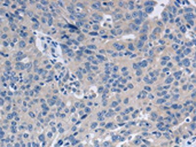 GRIN1 Antibody