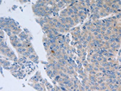 GRIN1 Antibody