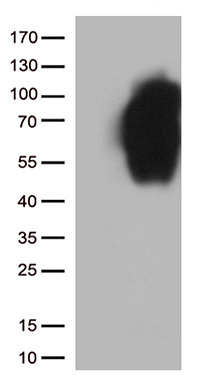 GRK1 Antibody