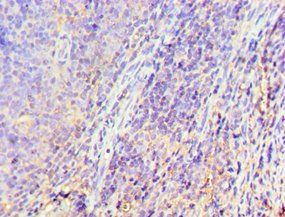 GRK6 Antibody
