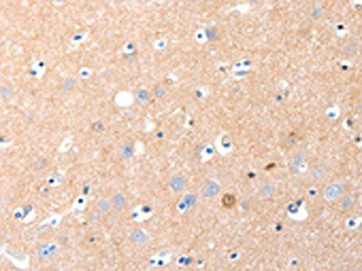 GRM1 Antibody