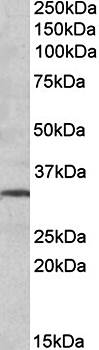 GRM2 Antibody