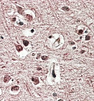GRM2 Antibody