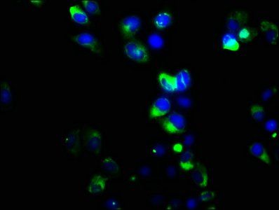 GRM6 Antibody