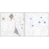 GRM7 Antibody