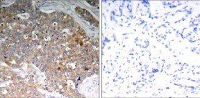 GSK3α/β(Phospho-Tyr279/216) Antibody