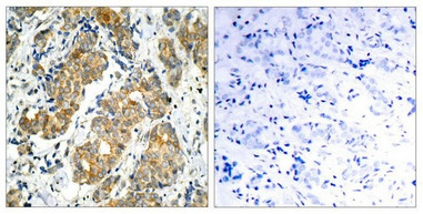 GSK3A Antibody