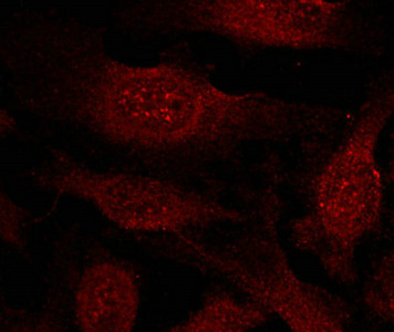 GSK3B Antibody