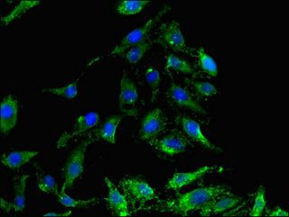GSK3B Antibody