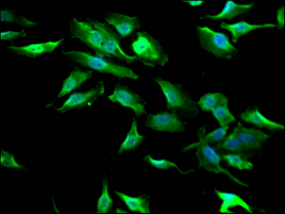 GSK3B Antibody