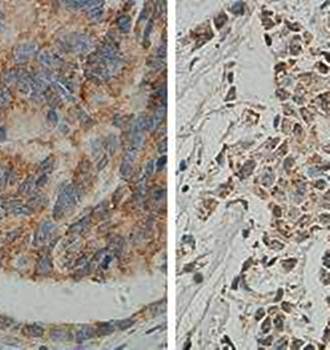 GSK3B Rabbit Polyclonal Antibody