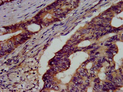 GSS Antibody