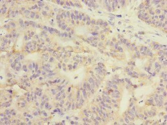 GSTK1 Antibody
