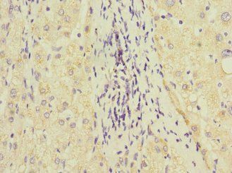 GSTK1 Antibody