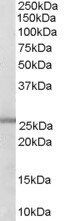 Goat anti-GSTM1 / GSTM2 Antibody