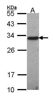 GSTO1 Rabbit Polyclonal Antibody