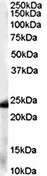 GST3/GSTP1 Antibody