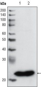 GSTP1 Antibody