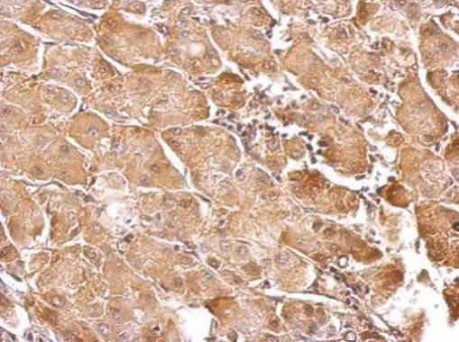 GSTT1 Rabbit Polyclonal Antibody