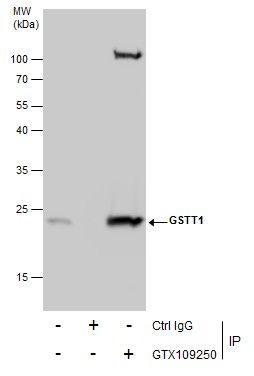 GSTT1 Rabbit Polyclonal Antibody
