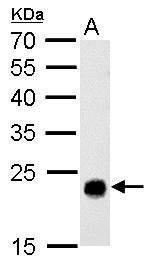 GSTT1 Rabbit Polyclonal Antibody