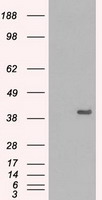 GTF2H3 Antibody