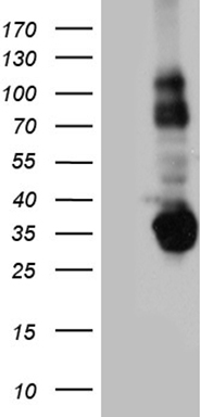 GTP cyclohydrolase 1 Antibody