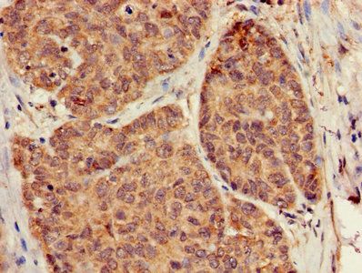 GNB5 Antibody