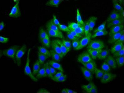 GUCY2D Antibody