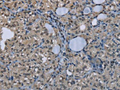 GYS1 Antibody