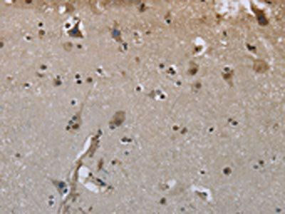 GYS1 Antibody