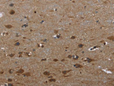 GYS1 Antibody